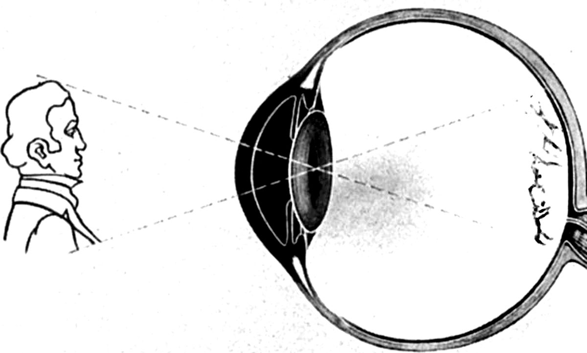 the inverted image in the eye