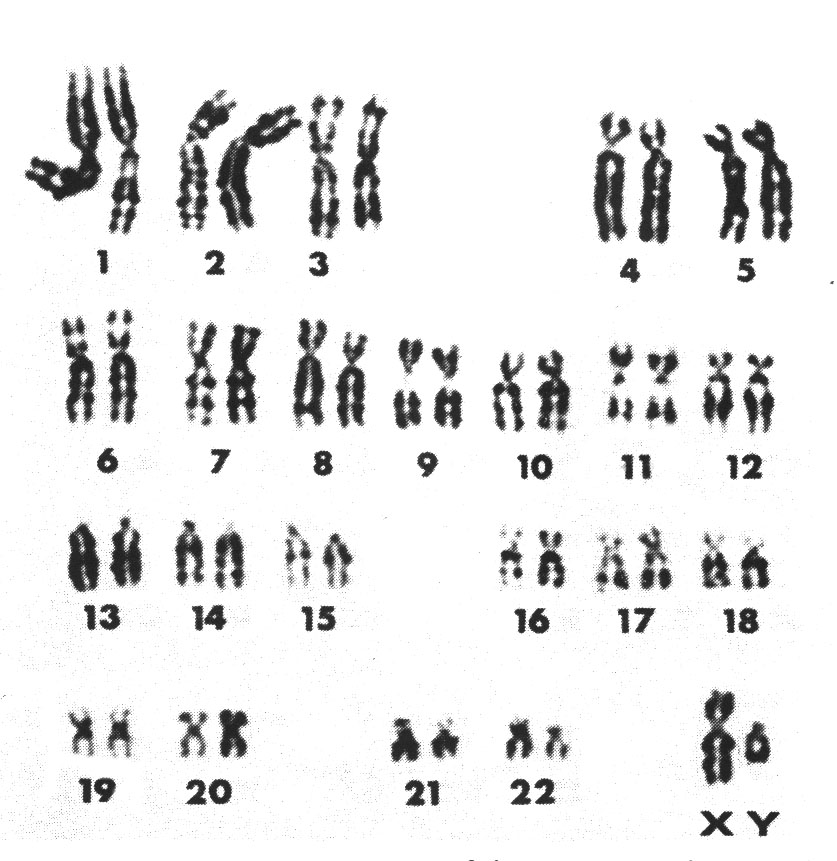 photograph of chromosomes